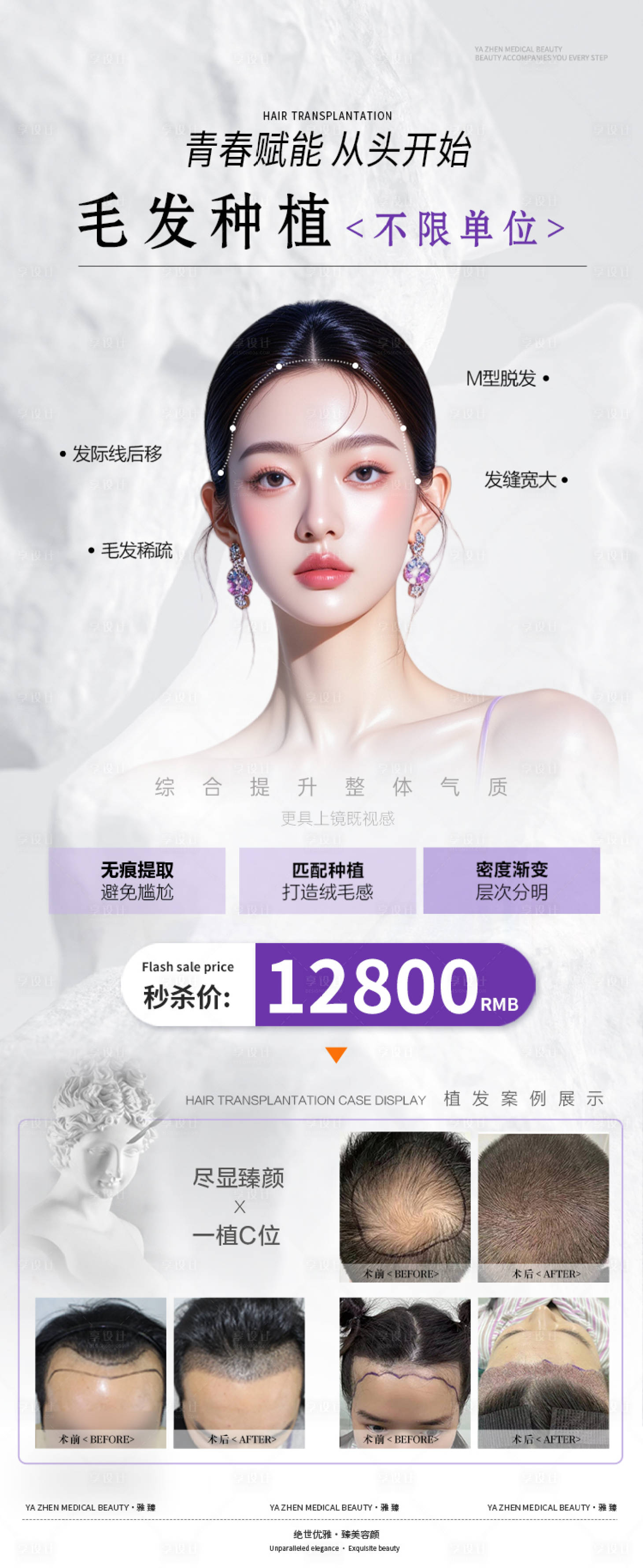 源文件下载【享设计】搜索编号：20590031909653915【植发活动海报】
