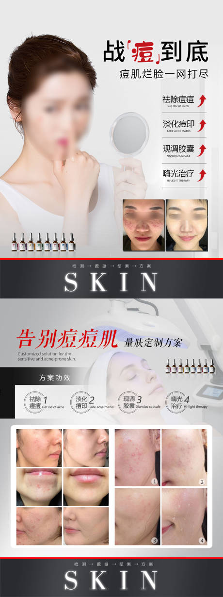 源文件下載【告別痘痘肌】編號：60240032229703036