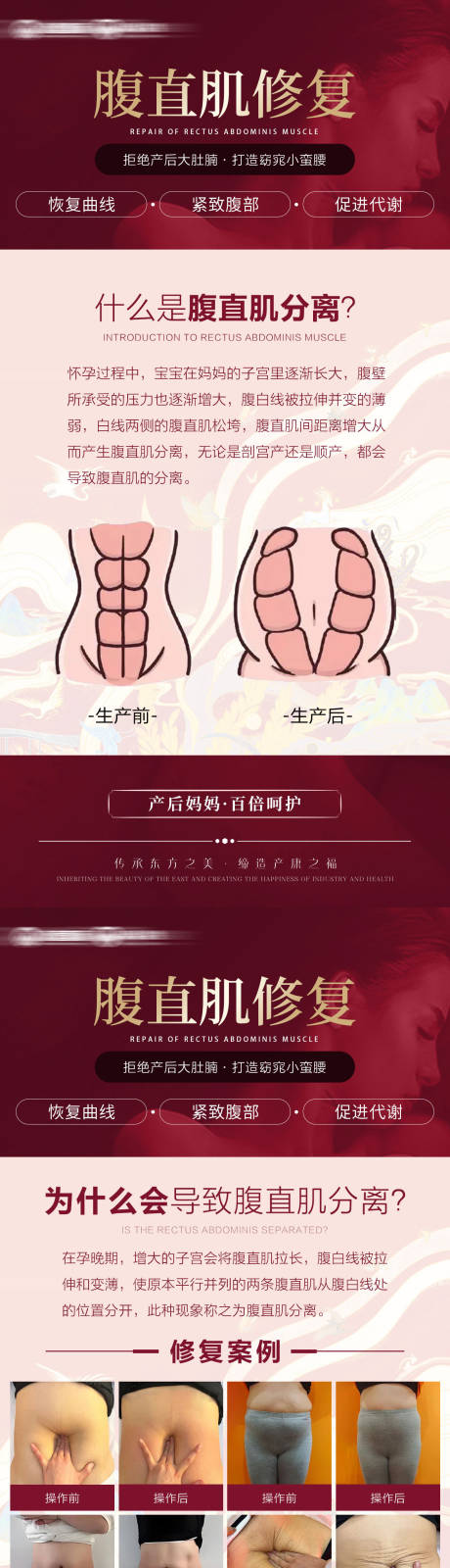 源文件下載【腹直肌修復(fù)海報】編號：30730032136552922