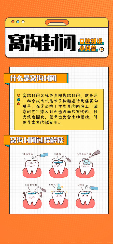 源文件下載【享設(shè)計(jì)】搜索編號：16230031822339008【兒童窩溝封閉口腔科普】