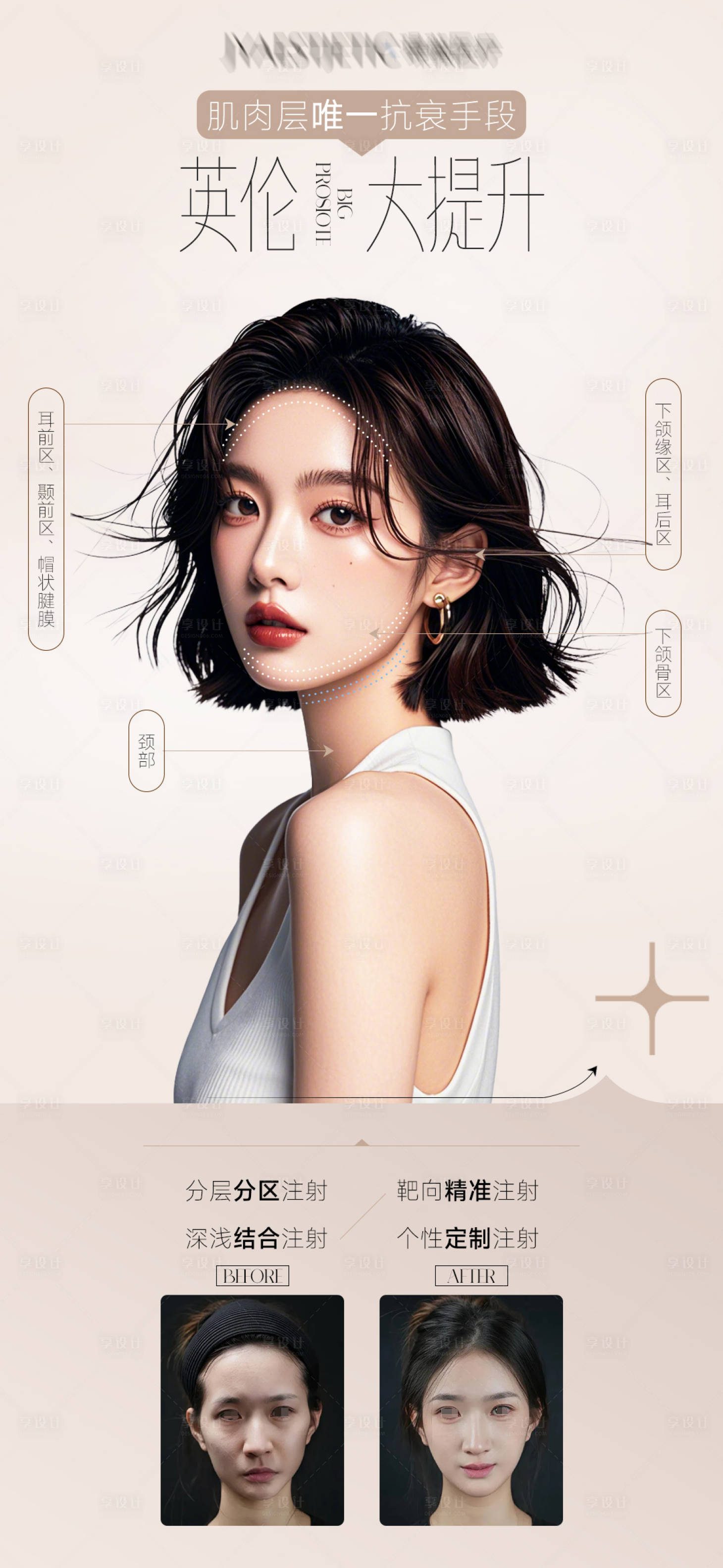 源文件下載【享設計】搜索編號：78170032137153593【英倫大提升面部抗衰案例宣傳海報】