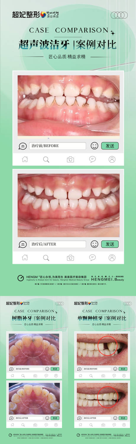 源文件下载【享设计】搜索编号：60790032124136712【口腔案例对比海报】