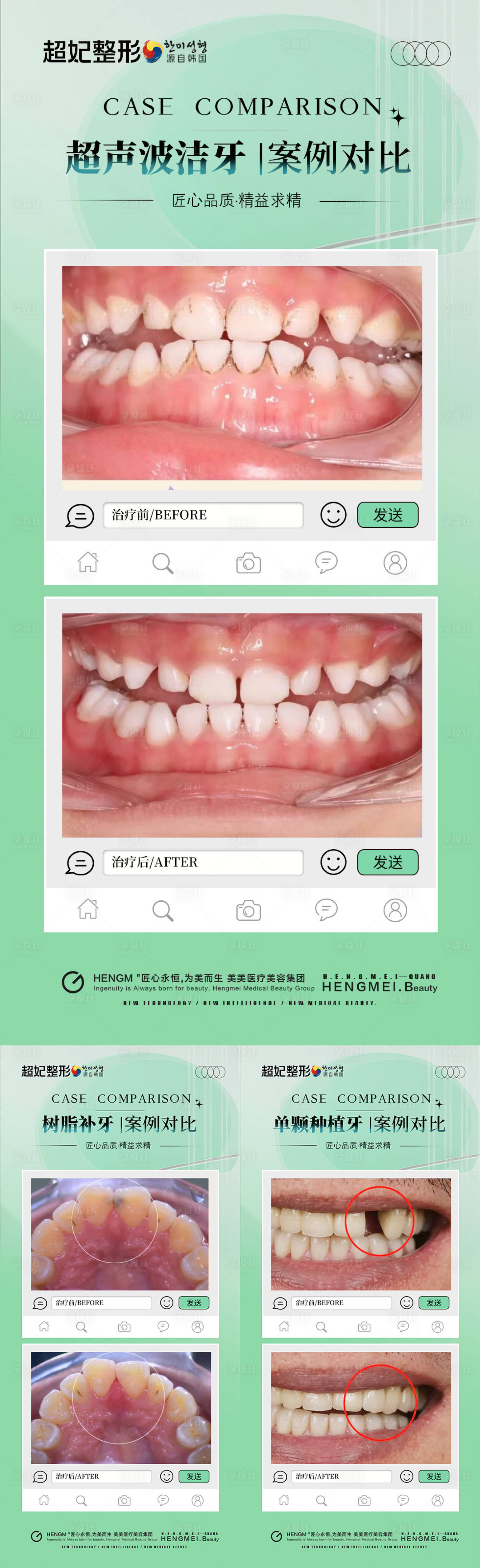 源文件下载【享设计】搜索编号：60790032124136712【口腔案例对比海报】