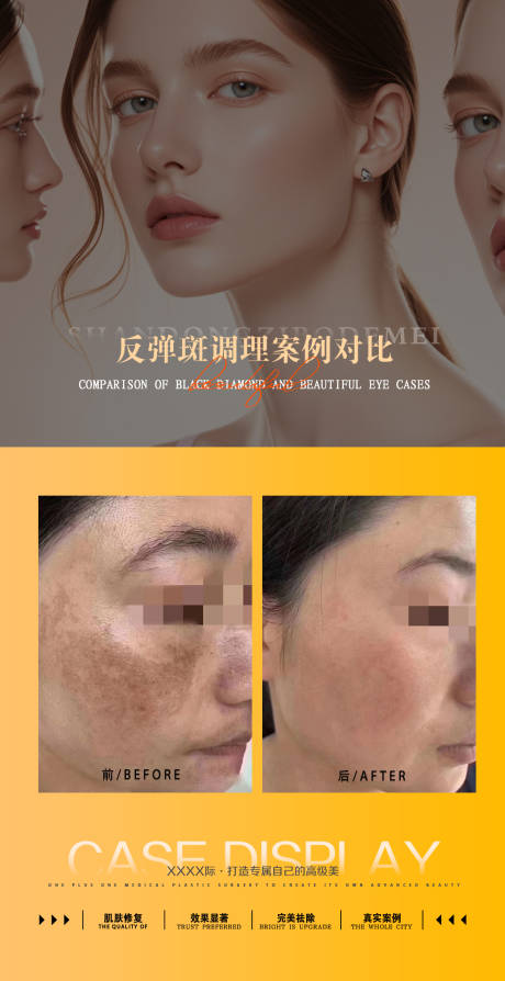源文件下载【享设计】搜索编号：32100032011223502【案例对比】