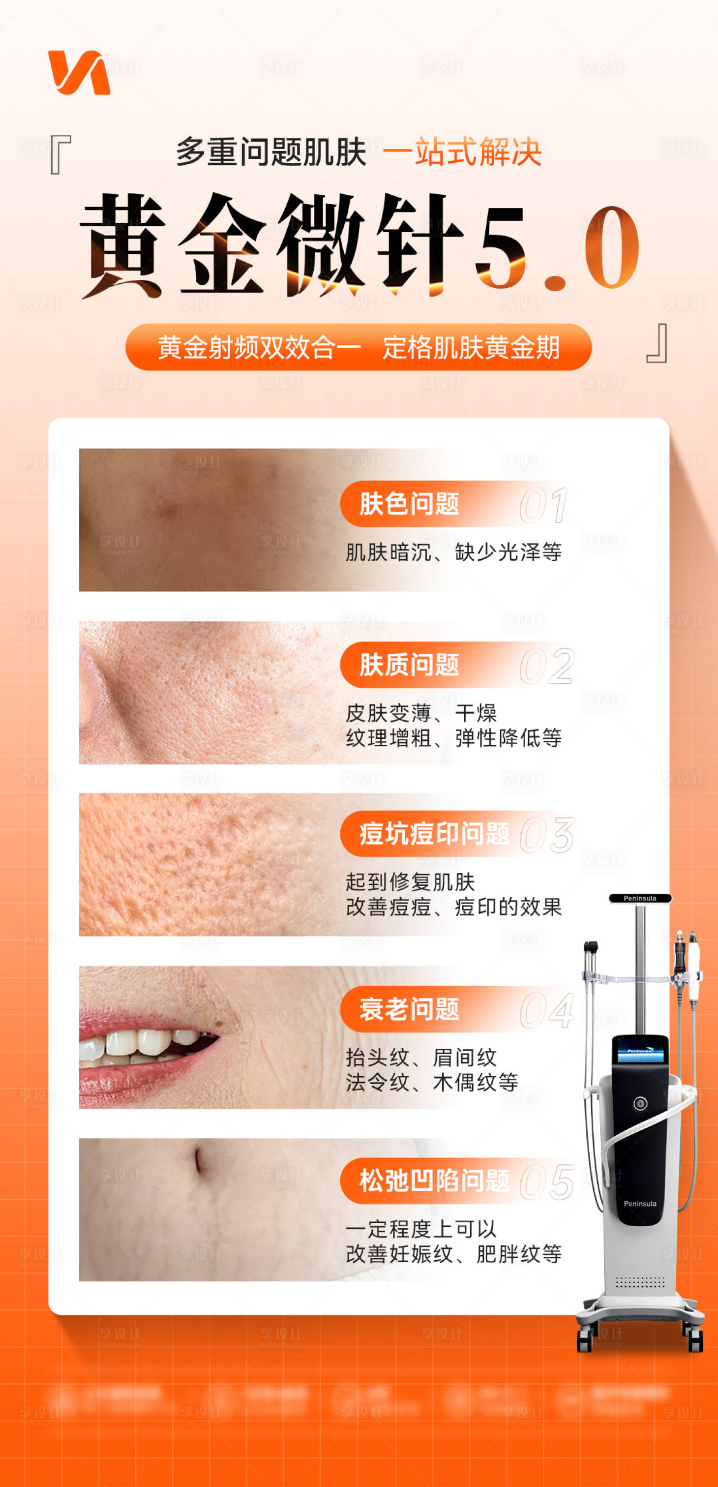 源文件下載【享設(shè)計(jì)】搜索編號：78820032055898195【黃金微針宣傳海報(bào)】