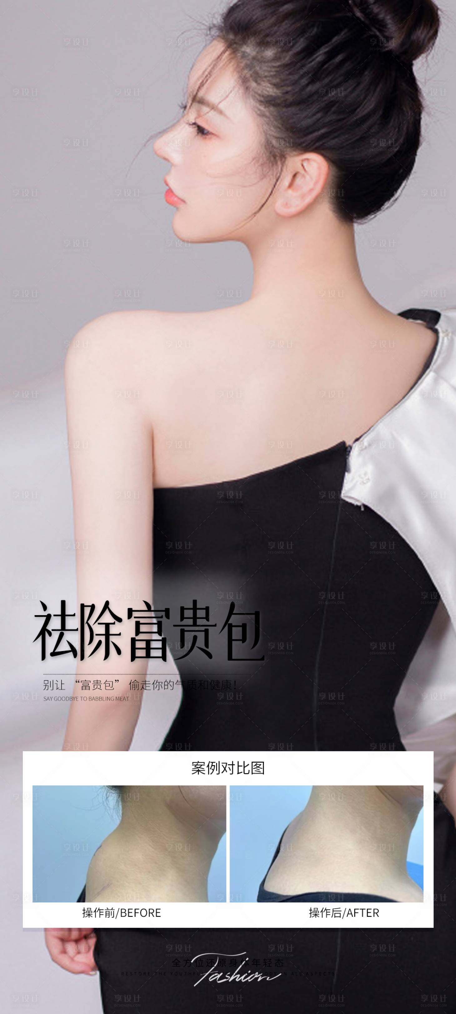 源文件下载【享设计】搜索编号：47730031891171158【富贵包祛除】