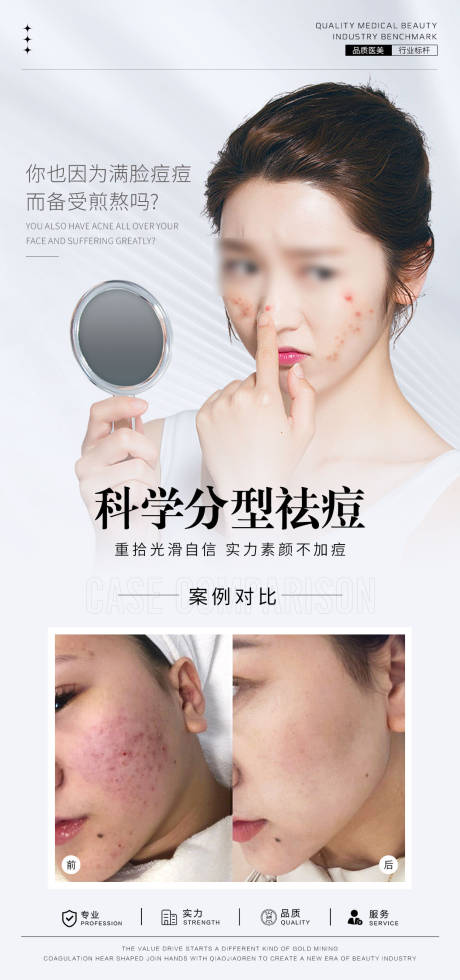 源文件下載【享設計】搜索編號：90170031791418117【祛痘案例對比海報】