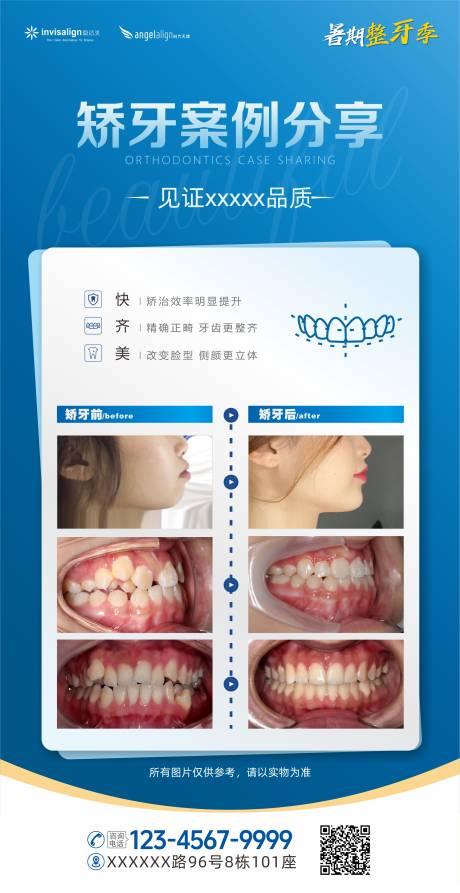 源文件下载【享设计】搜索编号：91840031858647176【口腔矫正牙案例分享海报】