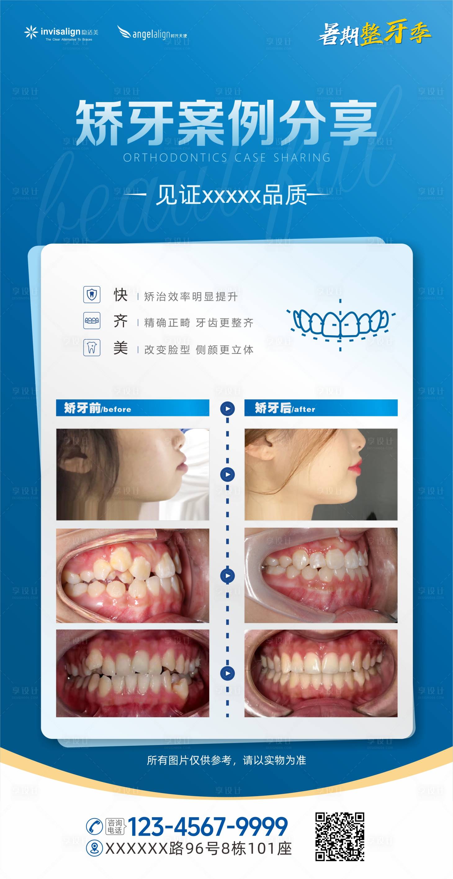 源文件下载【享设计】搜索编号：91840031858647176【口腔矫正牙案例分享海报】