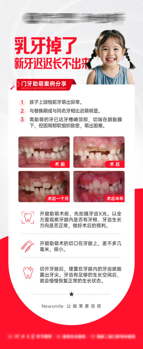源文件下载【乳牙掉了科普海报】编号：55320031731604117