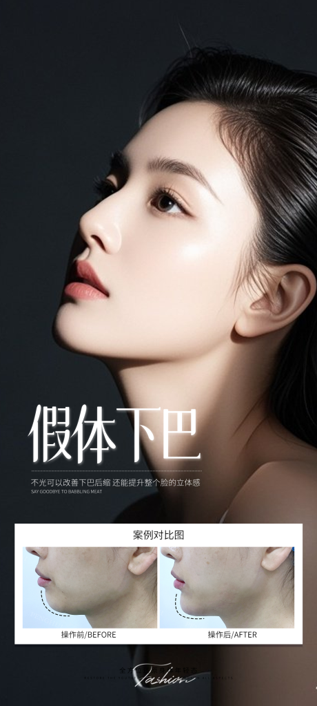 源文件下载【假体下巴海报】编号：27190031766437279