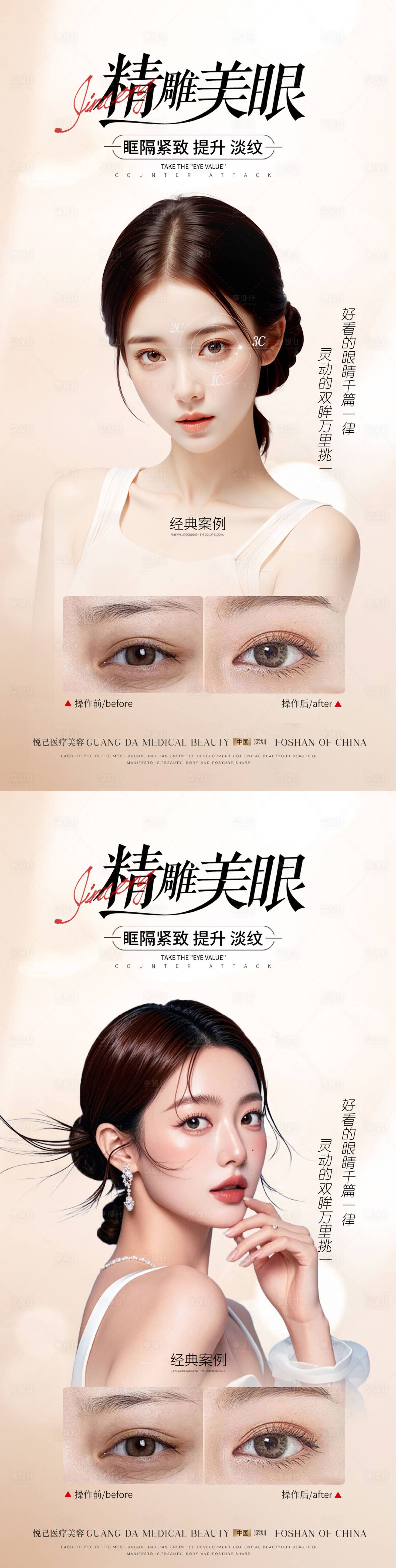 源文件下载【享设计】搜索编号：70660031816541402【医美双眼皮案例海报】