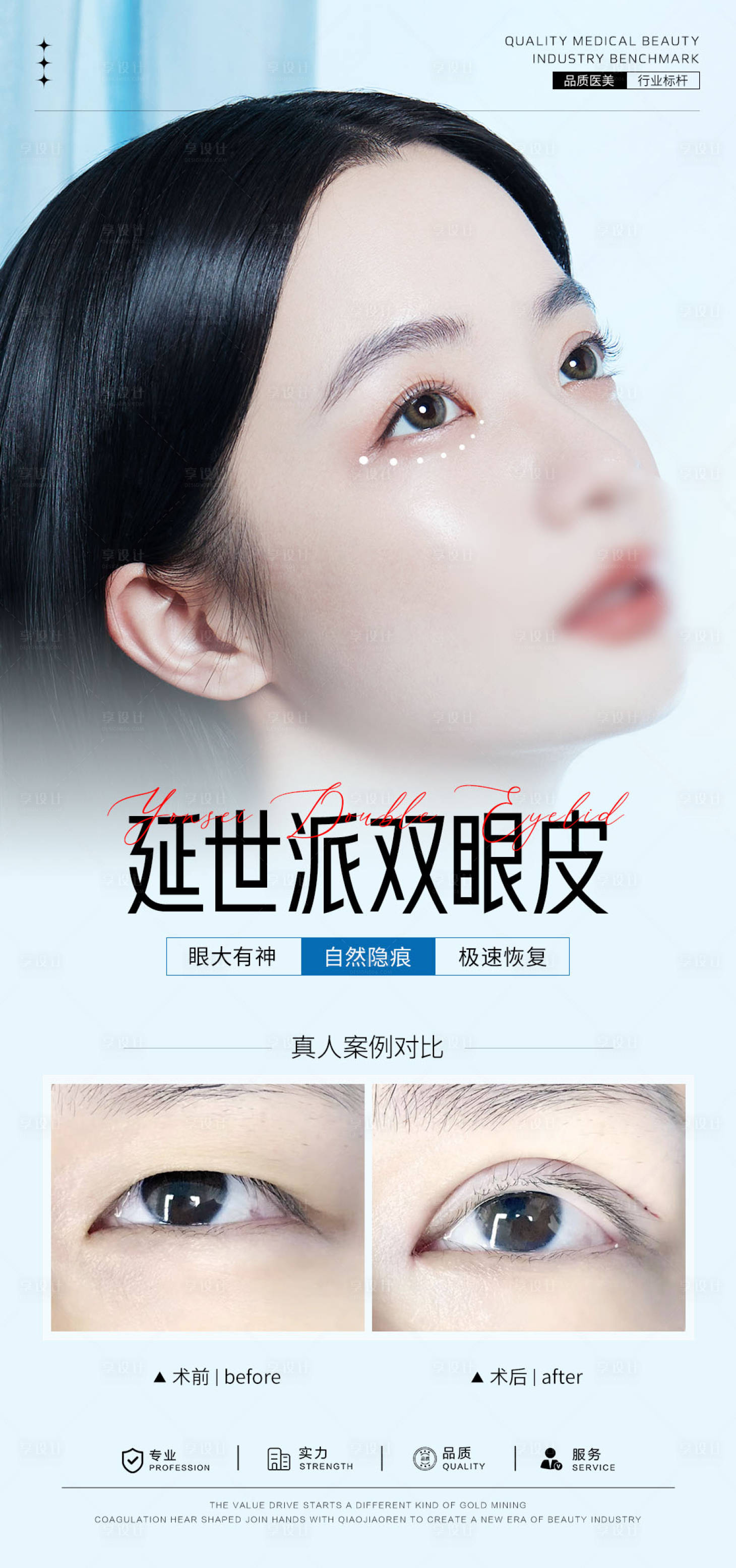 源文件下载【享设计】搜索编号：10330031791577128【双眼皮案例海报】