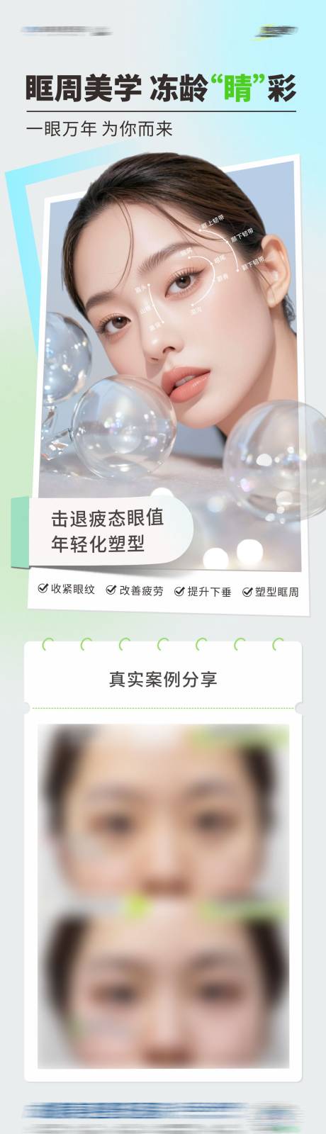 源文件下载【医美眼睛眶周美学案例长图 】编号：12780031874341889