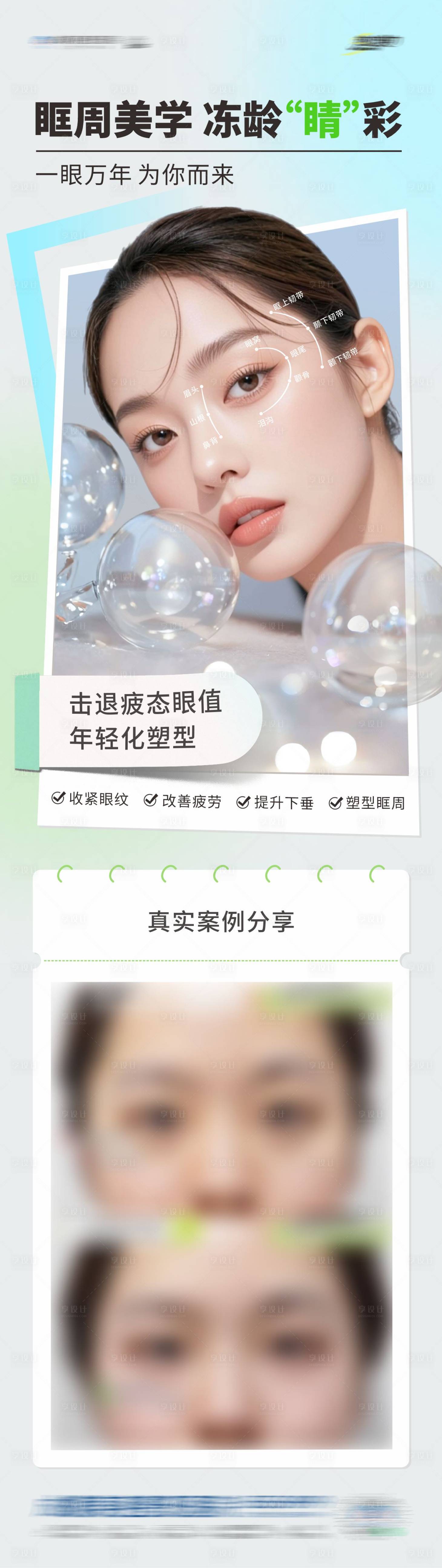 源文件下載【享設計】搜索編號：12780031874341889【醫美眼睛眶周美學案例長圖 】
