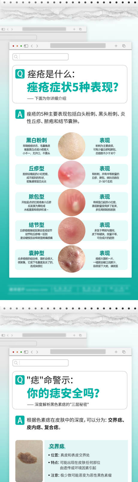 源文件下载【享设计】搜索编号：98460032199498088【痤疮黑痣科普】