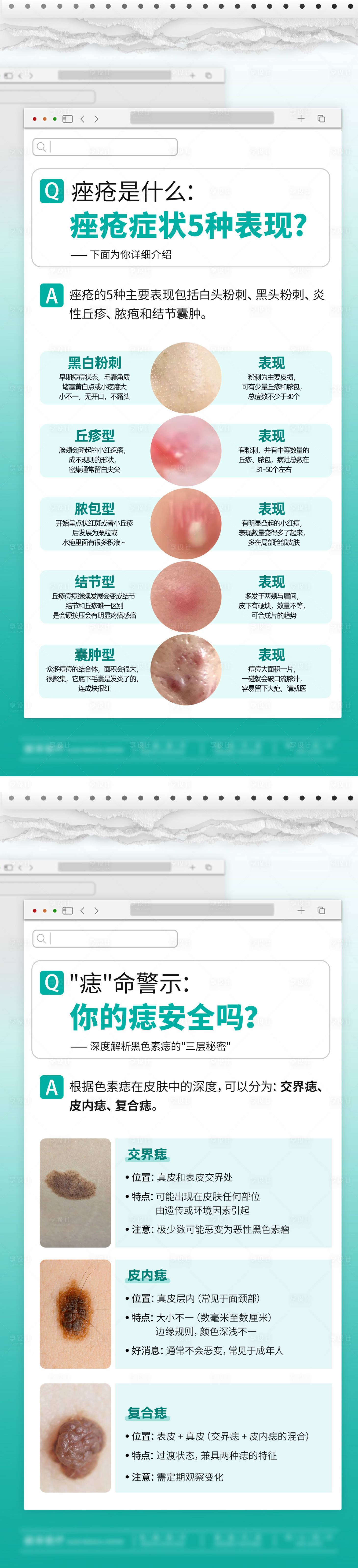 源文件下載【享設計】搜索編號：98460032199498088【痤瘡黑痣科普】