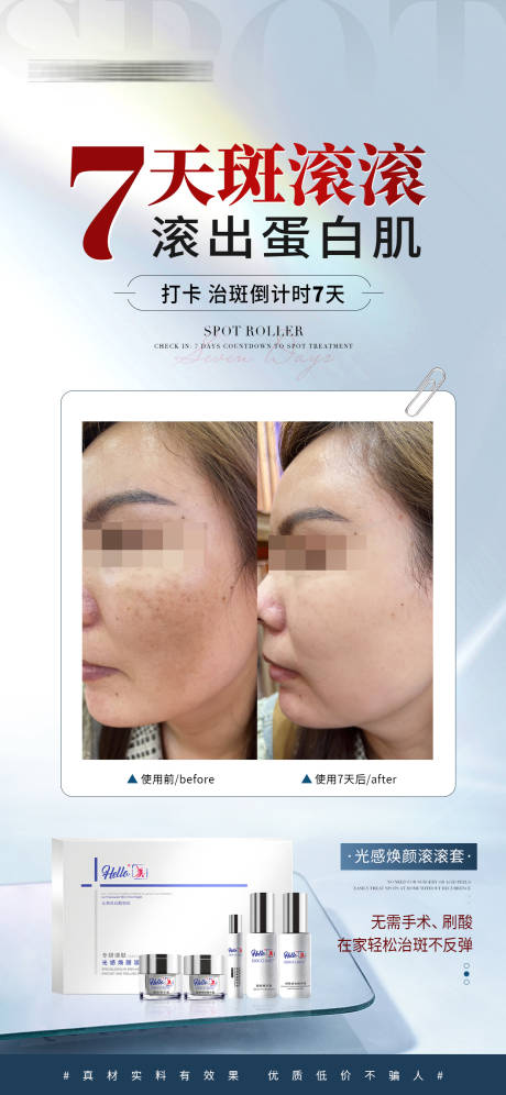 源文件下載【享設計】搜索編號：96610031896375829【醫美美業淡斑對比海報】