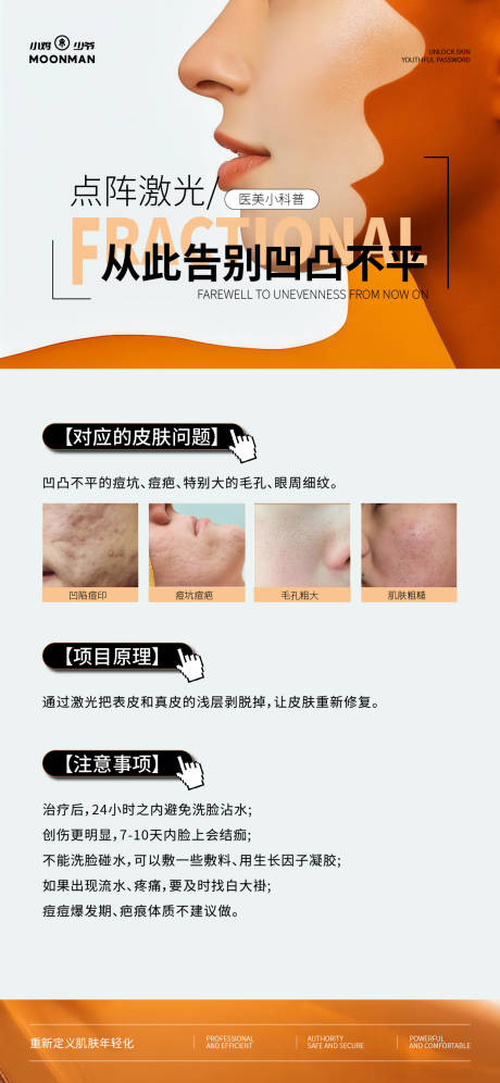 源文件下載【醫美點陣激光海報】編號：34740032080709850
