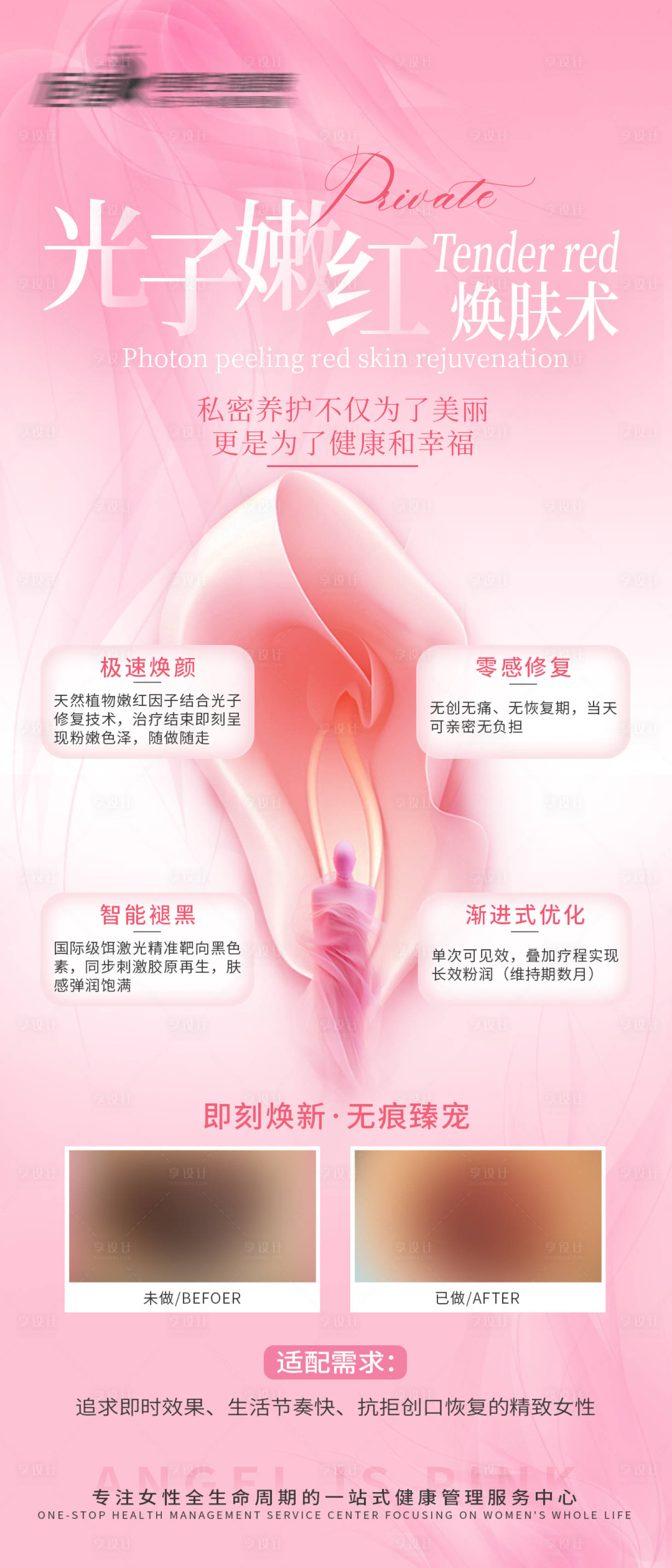 源文件下载【享设计】搜索编号：90400031802925561【私密医美美业光子嫩红粉嫩宣传海报】