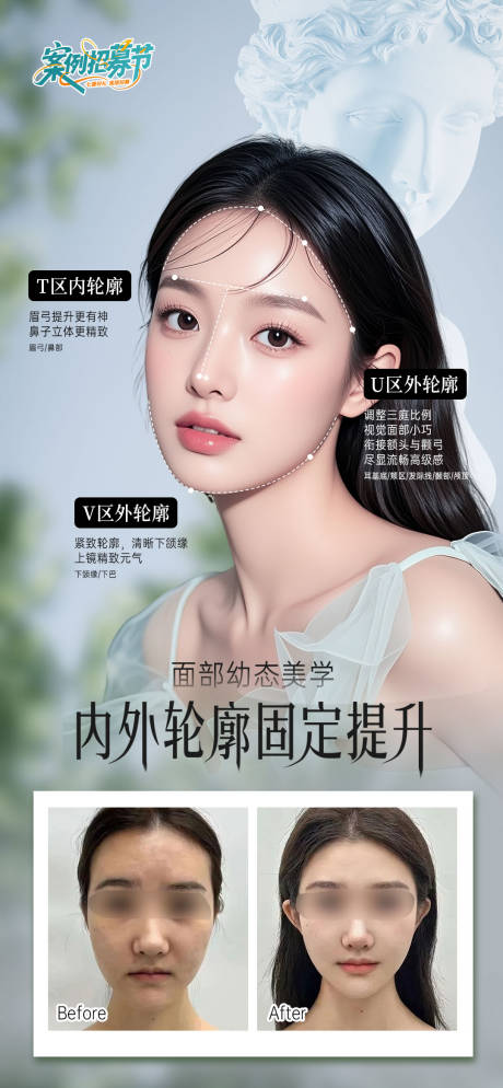 源文件下载【医美内外轮廓固定提升海报】编号：62720032099115841