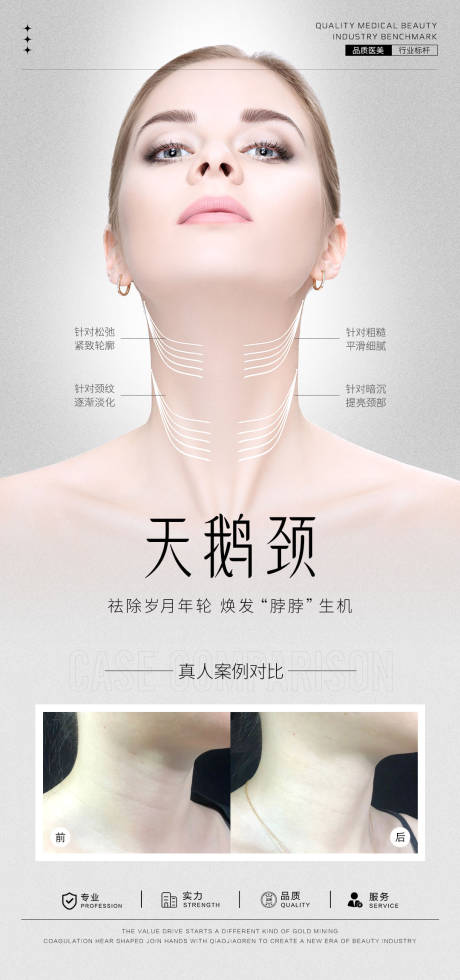 天鹅颈案例海报