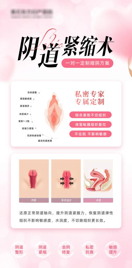 源文件下載【享設計】搜索編號：97080032157754503【陰道緊縮】