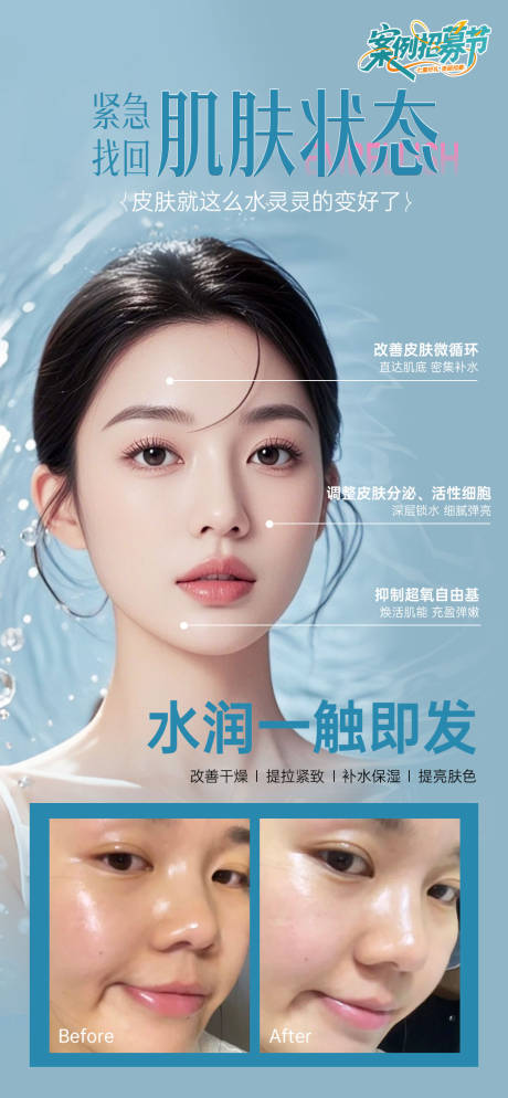 源文件下載【醫美水光肌案例對比人物海報】編號：86740032152633310