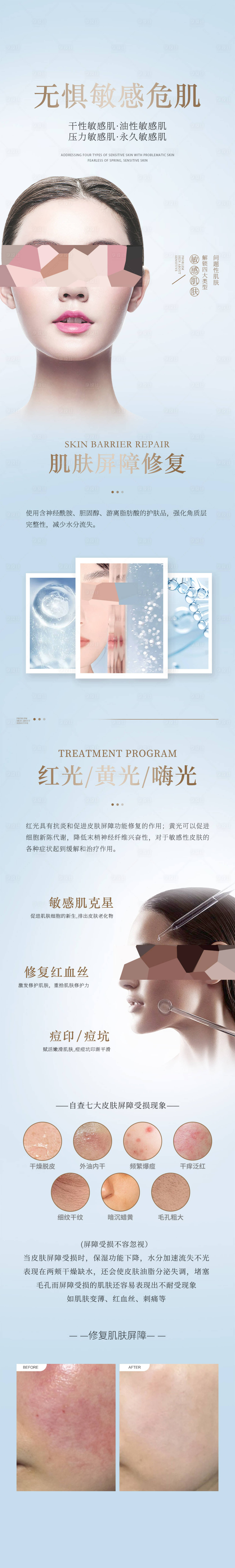 源文件下载【敏感肌科普】编号：80690032130578498