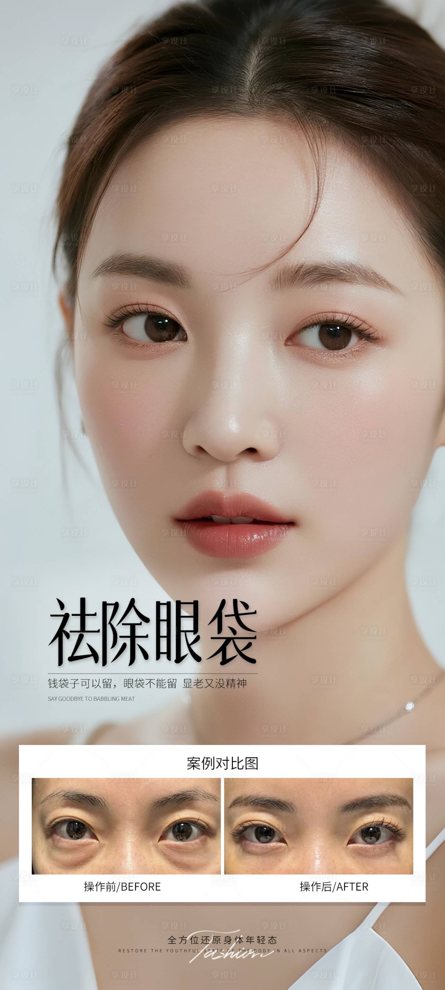 源文件下載【享設計】搜索編號：43940032115469446【祛除眼袋案例】