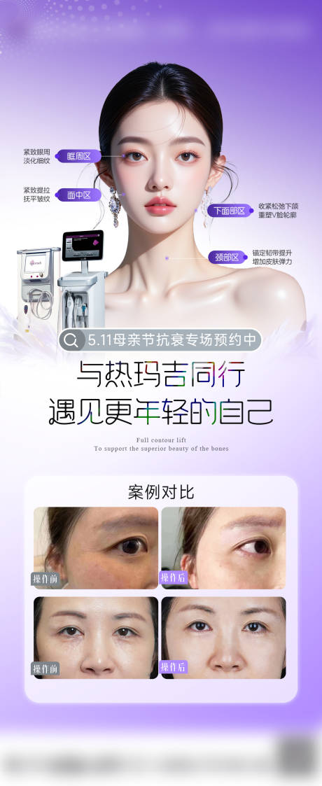源文件下载【医美热玛吉海报】编号：64030031863891725