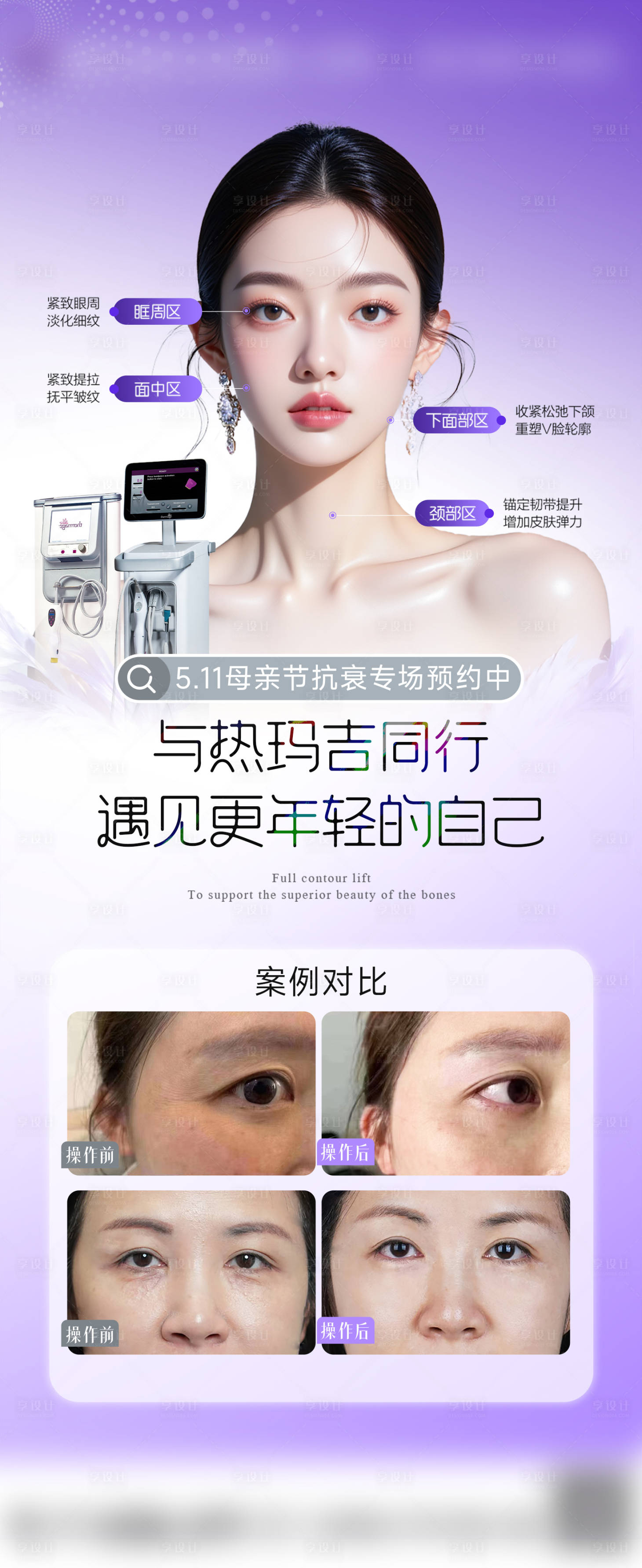 源文件下載【享設計】搜索編號：64030031863891725【醫(yī)美熱瑪吉海報】
