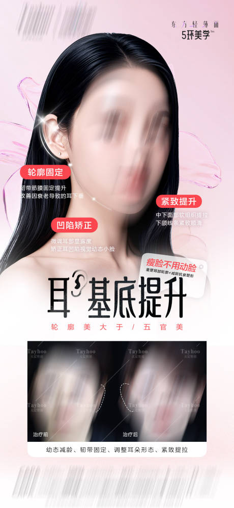 源文件下载【享设计】搜索编号：47100032254758203【耳基底提升】