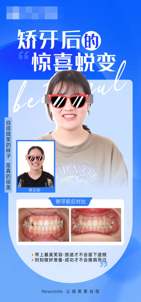 源文件下载【口腔矫正案例对比海报】编号：36760031871713210