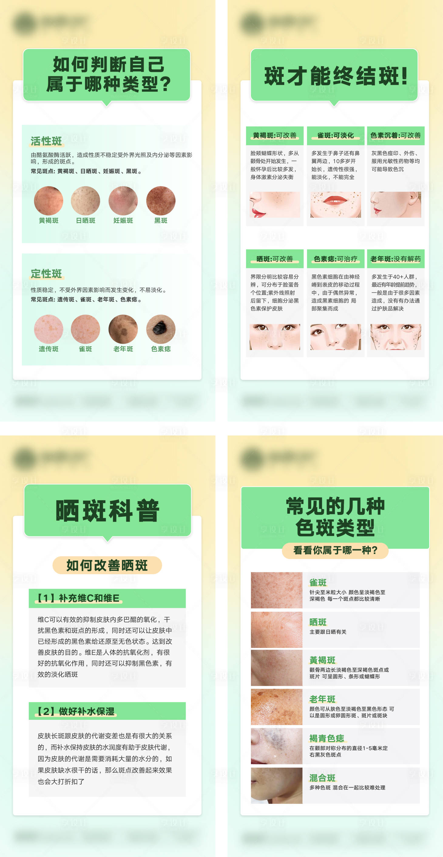 源文件下载【享设计】搜索编号：54790032253261076【科普斑的类型】