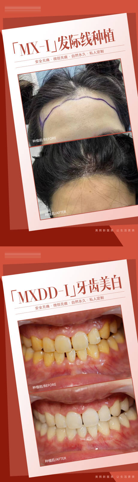 源文件下載【享設計】搜索編號：32420031913877810【口腔植發案例】