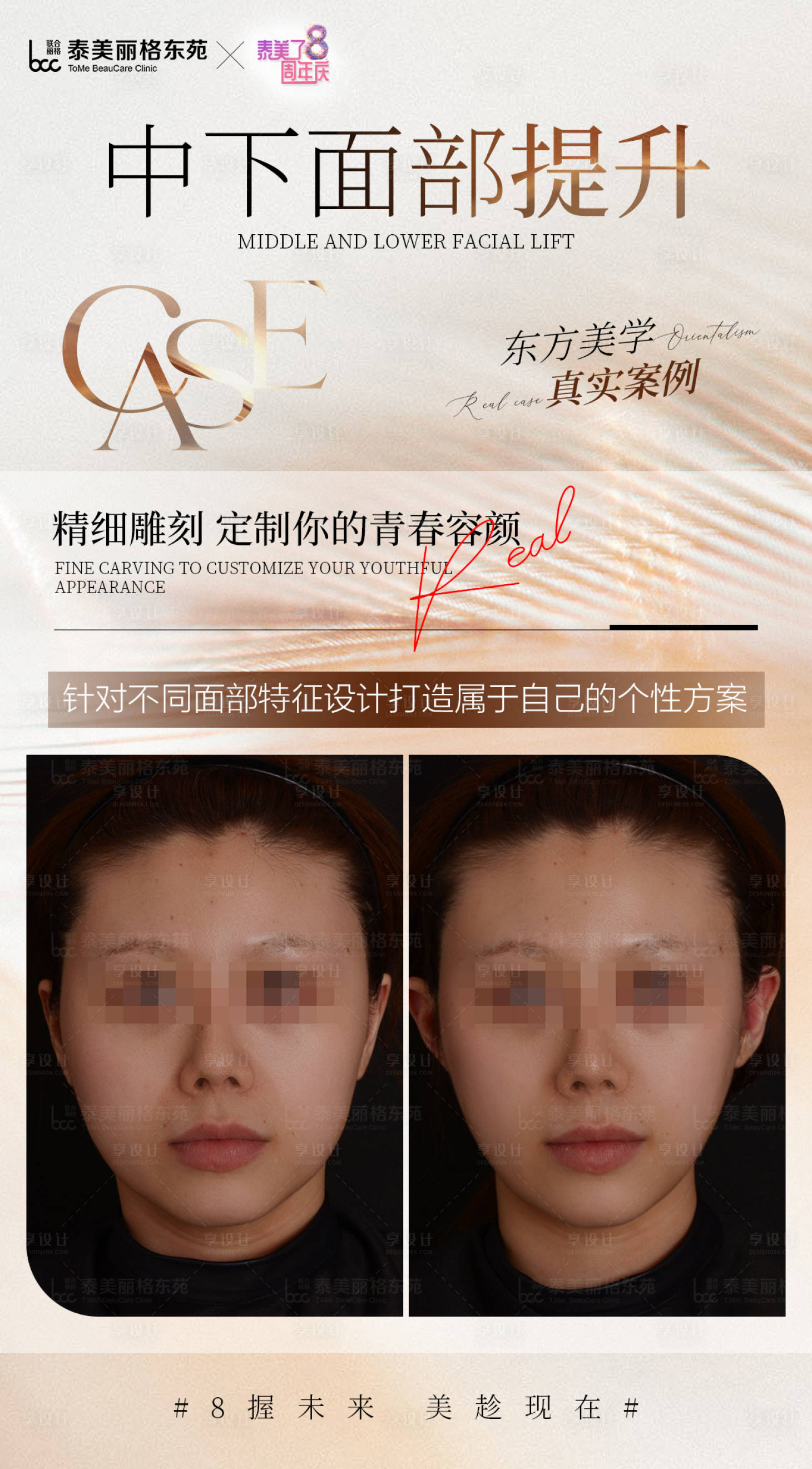 源文件下载【享设计】搜索编号：81490031724777327【医美案例海报】