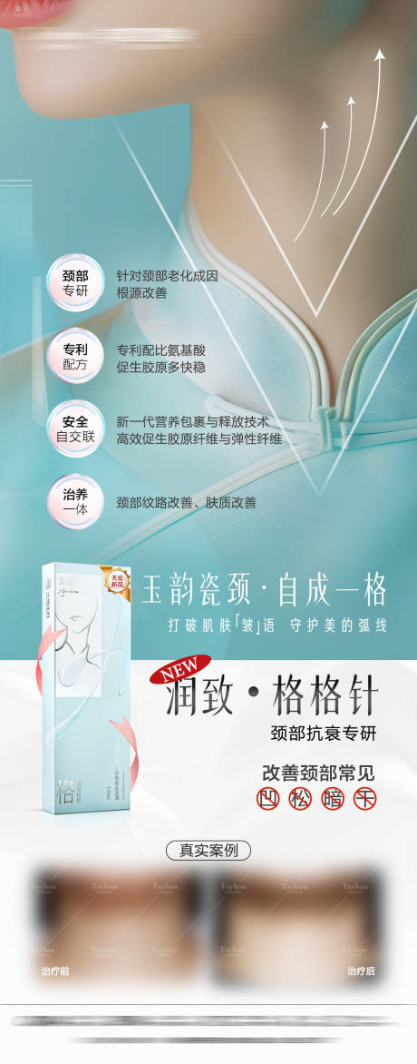 源文件下载【格格针】编号：77570031942994939