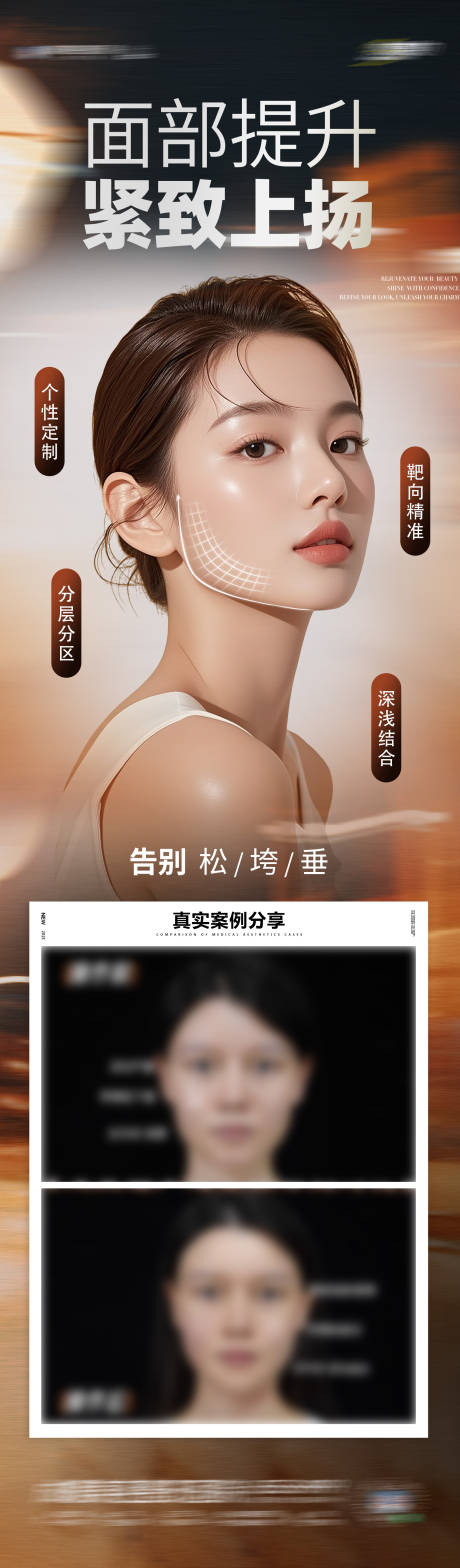 源文件下載【醫美面部提升抗衰年輕化案例創意海報】編號：55190032065264237
