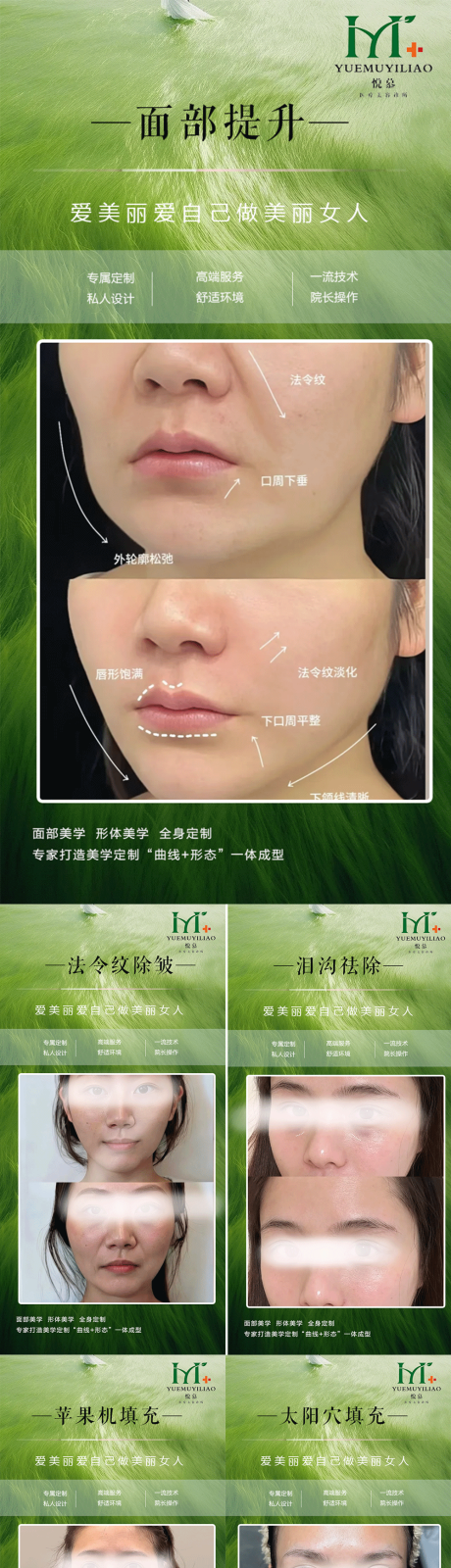 源文件下載【享設(shè)計(jì)】搜索編號(hào)：69130032055612104【醫(yī)美案例】