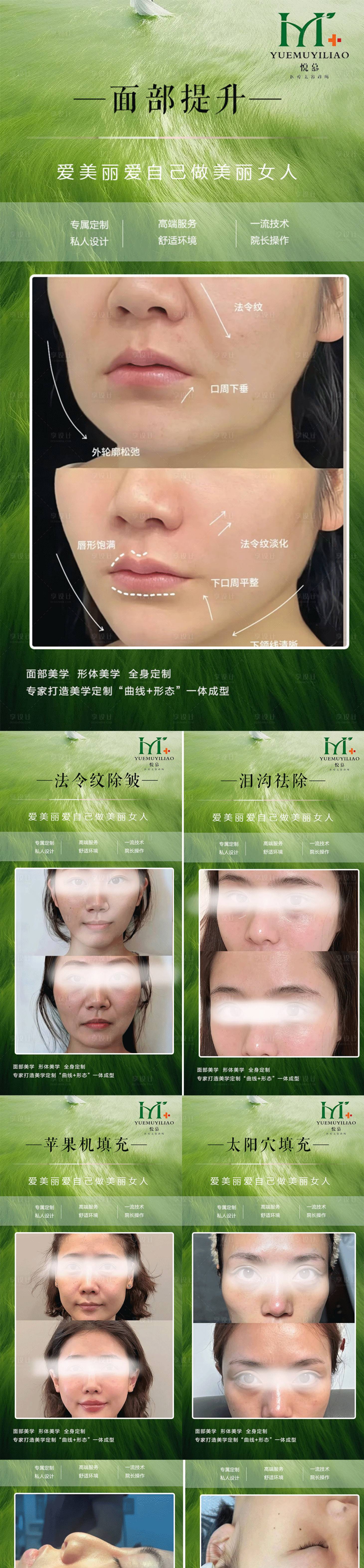源文件下載【享設計】搜索編號：69130032055612104【醫美案例】