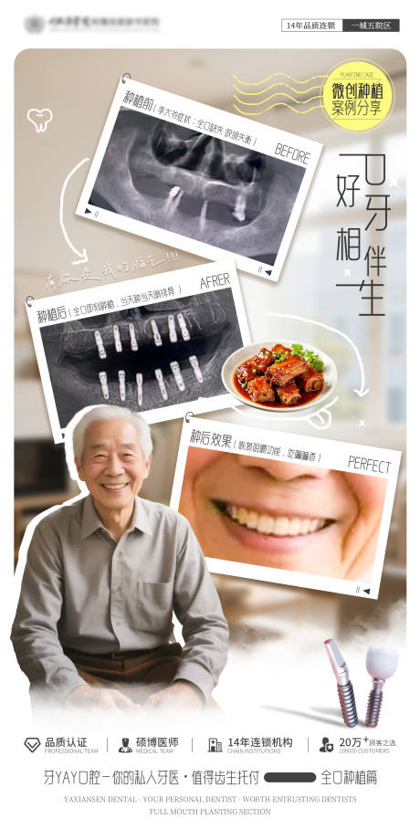 源文件下载【口腔种植案例海报】编号：79650032143321740