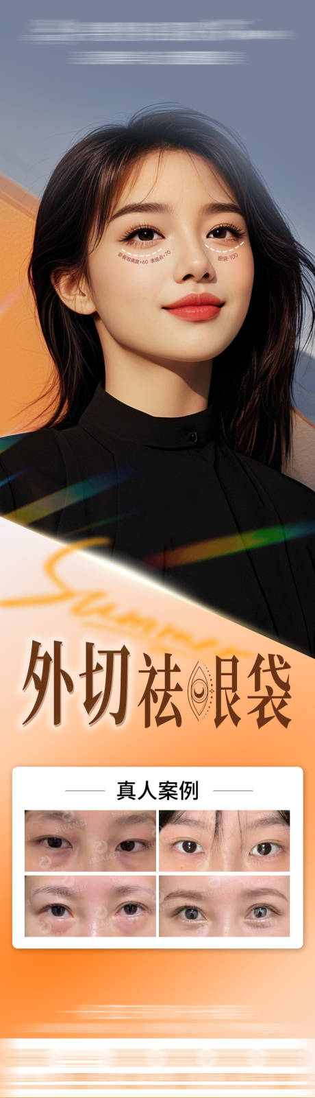源文件下载【医美外切祛眼袋长图】编号：32230031808197899