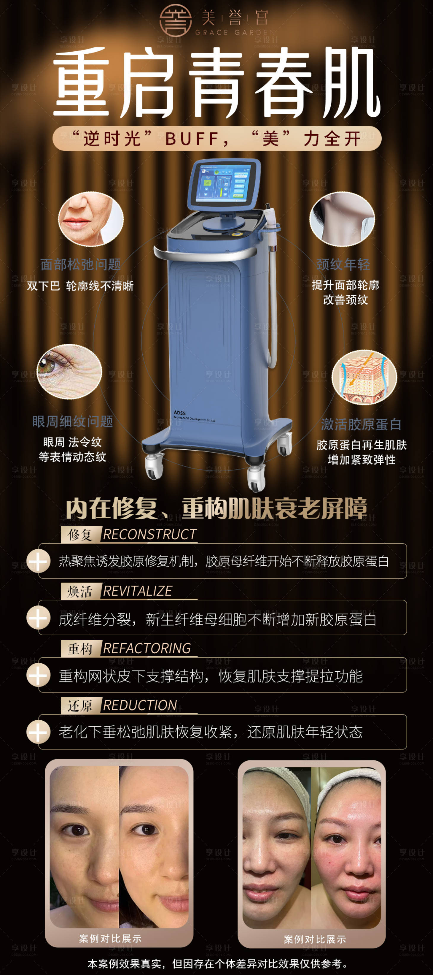 源文件下载【逆龄王者仪器 】编号：90270032025068603