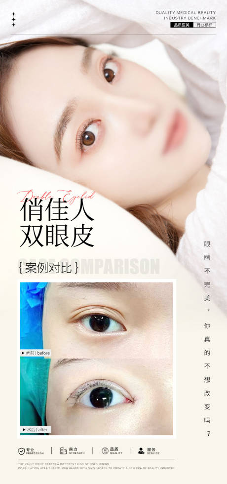 源文件下載【享設計】搜索編號：98330031791364029【雙眼皮案例海報】