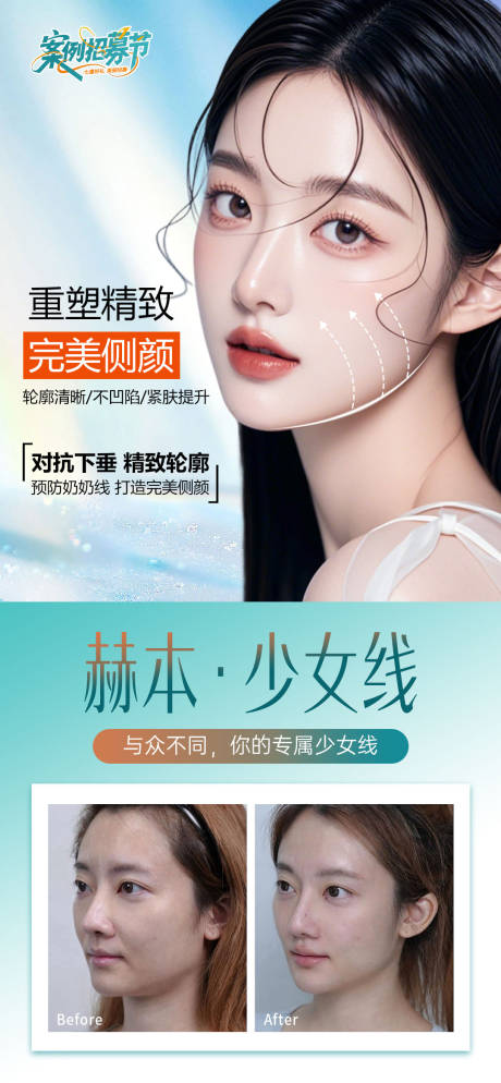 源文件下載【少女線醫美海報】編號：25790032098985073