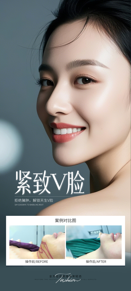 源文件下载【紧致V脸案例海报】编号：28330031783027272