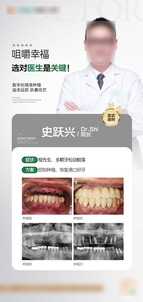源文件下載【享設計】搜索編號：91650032139538501【口腔種植案例海報】