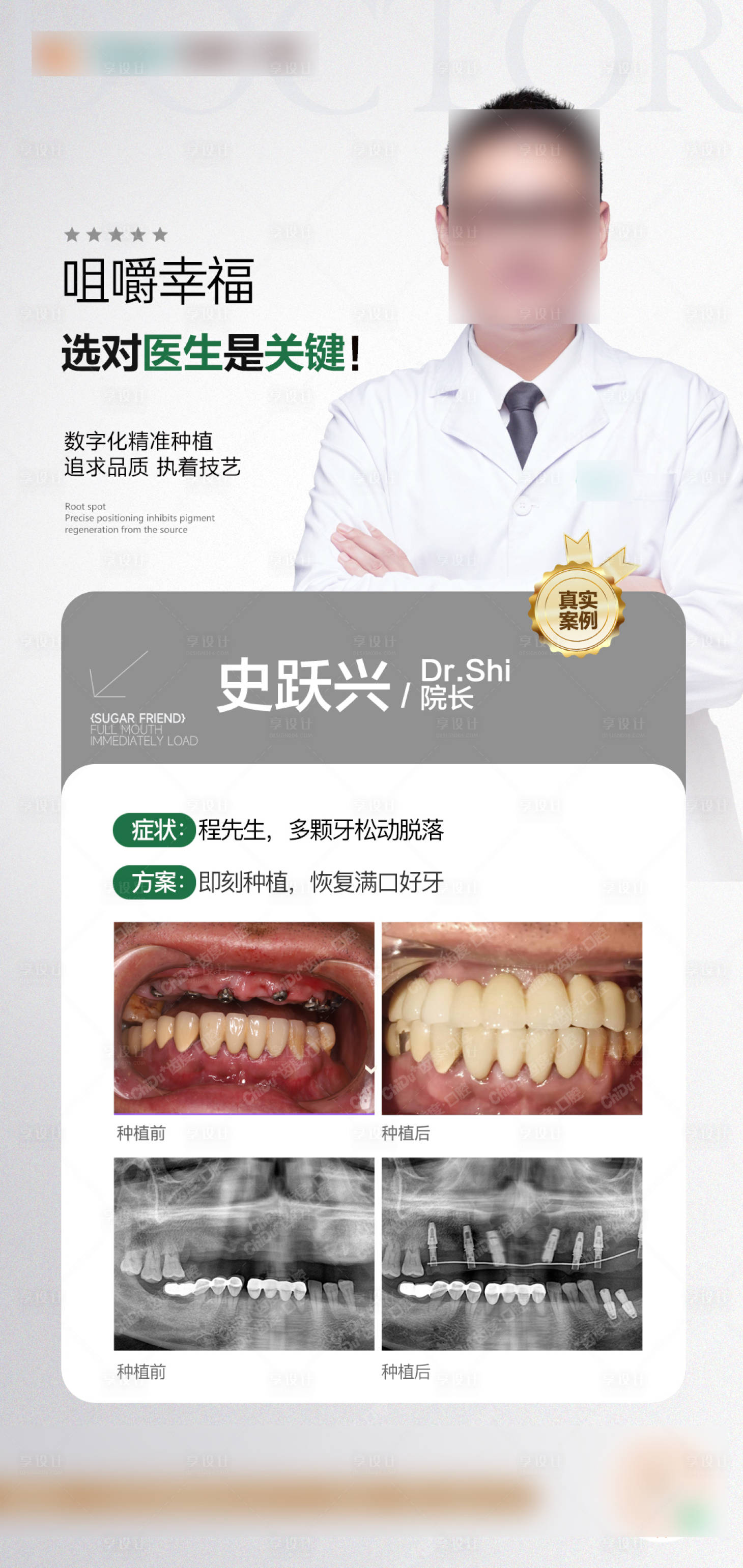源文件下載【享設計】搜索編號：91650032139538501【口腔種植案例海報】