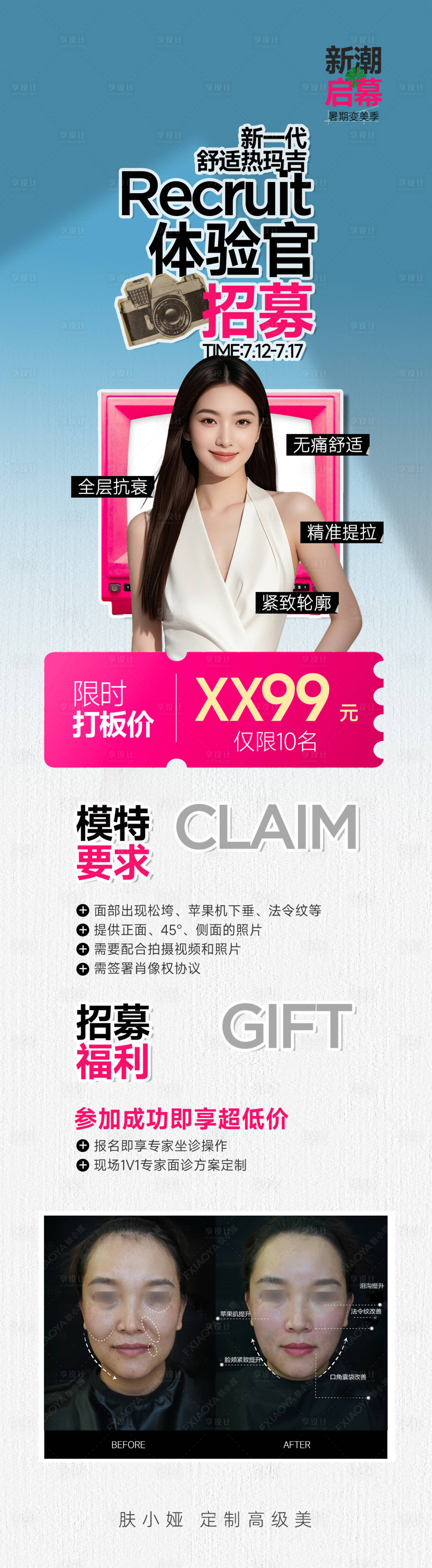 源文件下載【享設(shè)計(jì)】搜索編號(hào)：33200031922992732【醫(yī)美熱瑪吉案例招募長圖】